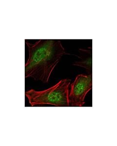 Cell Signaling Daxx (25c12) Rabbit mAb