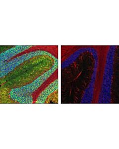 Cell Signaling Phospho-Map2 (Ser136) Antibody