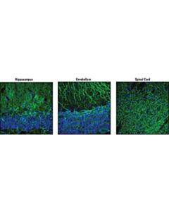 Cell Signaling Map2 Antibody