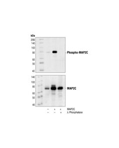 Cell Signaling Phospho-Map2 (Thr1620/1623) Antibody