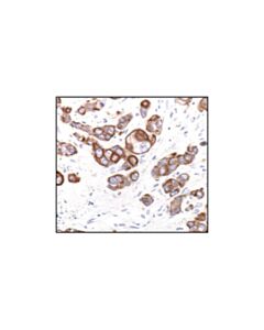Cell Signaling Keratin 18 (Dc10) Mouse mAb