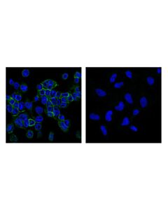Cell Signaling Cd11c (D3v1e) Xp Rabbit mAb