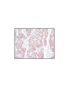 Cell Signaling Keratin 19 (Ba17) Mouse mAb