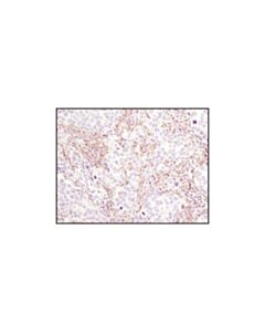Cell Signaling Pdgf Receptor Beta (C82a3) Rabbit mAb