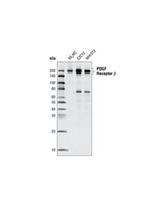 Cell Signaling PDGF Receptor beta (C82A3) Rabbit mAb 20 uL