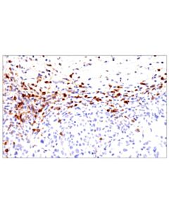 Cell Signaling Cd62l/L-Selectin (E7l2m) Rabbit mAb