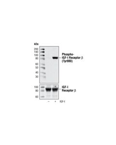 Cell Signaling Phospho-Igf-I Receptor Beta (Tyr980) (C14a11) Rabbit mAb