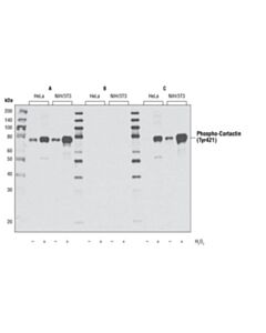 Cell Signaling Phospho-Cortactin (Tyr421) Antibody