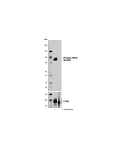 Cell Signaling Phospho-Psd95 (Ser295) (A8f8z) Rabbit mAb