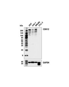 Cell Signaling CDK12 (E8G6X) Rabbit mAb