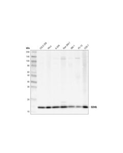 Cell Signaling SDH5 (D1S8D) Rabbit mAb 20 uL