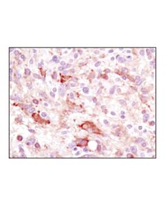 Cell Signaling Bik Antibody