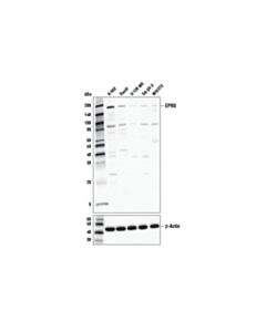 Cell Signaling Eprs Antibody
