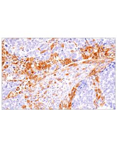 Cell Signaling Dap12 (E8p9u) Rabbit mAb
