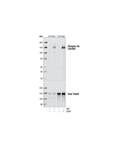 Cell Signaling Phospho-Trka (Tyr490)/Trkb (Tyr516) (C35g9) Rabbit mAb