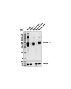 Cell Signaling Keratin 14 Antibody