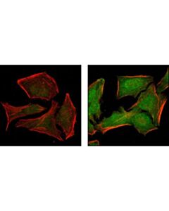 Cell Signaling Phospho-P38 Mapk (Thr180/Tyr182) (12f8) Rabbit mAb