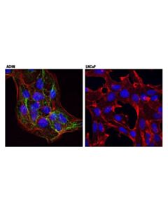 Cell Signaling Cavin-1 (D8c1d) Rabbit mAb