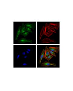 Cell Signaling Rab5a (E6n8s) Mouse mAb