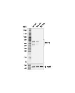 Cell Signaling MTF2 (F2X1A) Rabbit mAb 100 µl