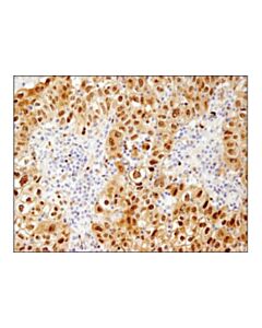 Cell Signaling Hsp70 (D1m6j) Mouse mAb