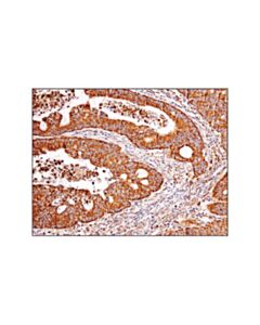 Cell Signaling Vdac (D73d12) Rabbit mAb