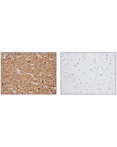 Cell Signaling Tau (D1m9x) Xp Rabbit mAb
