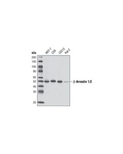 Cell Signaling beta-Arrestin 1/2 (D24H9) Rabbit mAb 20 uL