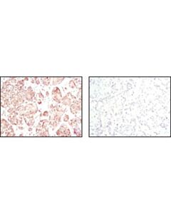 Cell Signaling Akt (Pan) (11e7) Rabbit mAb