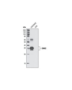 Cell Signaling Dkk2 (N70) Antibody