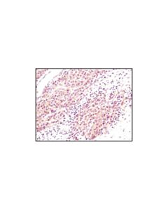 Cell Signaling Akt (Pan) (C67e7) Rabbit mAb