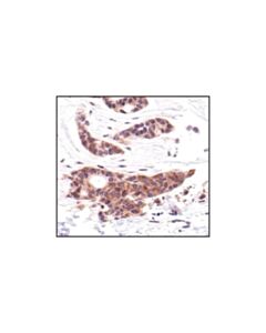 Cell Signaling Mek1/2 (L38c12) Mouse mAb