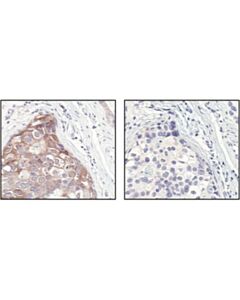 Cell Signaling C-Rel Antibody