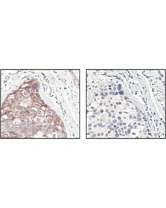 Cell Signaling C-Rel Antibody
