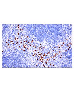 Cell Signaling S100a8 (E4f8v) Xp Rabbit mAb