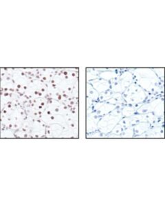 Cell Signaling Phospho-Rpb1 Ctd (Ser2/5) Antibody