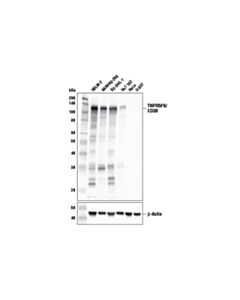 Cell Signaling Tnfrsf8/Cd30 (E4l4i) Xp Rabbit mAb (BSA And Azide Free)