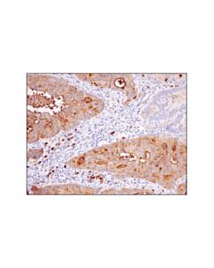 Cell Signaling CD15/SSEA1 (MC480) Mouse mAb 20 uL