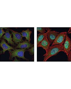 Cell Signaling Nf-Kappab P65 (C22b4) Rabbit mAb