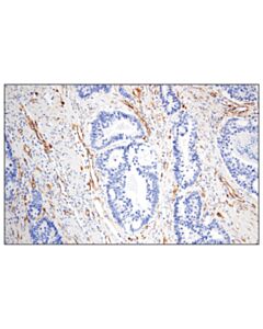 Cell Signaling Igfbp7 (E3z8l) Xp Rabbit mAb