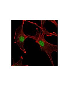 Cell Signaling Ubc9 (D26f2) Xp Rabbit mAb