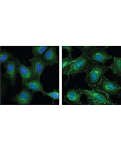 Cell Signaling Cdc37 (D11a3) Xp Rabbit mAb