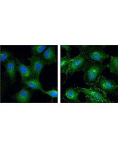 Cell Signaling Cdc37 (D11a3) Xp Rabbit mAb