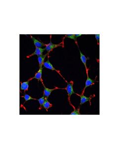 Cell Signaling Clathrin Heavy Chain (D3c6) Xp Rabbit mAb