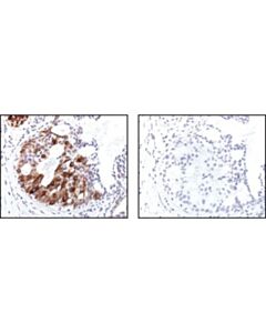 Cell Signaling Phospho-Nf-Kappab P105 (Ser932) (178f3) Rabbit mAb (Ihc Specific)