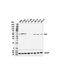 Cell Signaling RILP (F1H4O) Rabbit mAb 100 uL