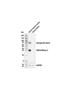 Cell Signaling Fbp2/Fbpase 2 (E9m5t) Rabbit mAb
