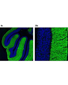 Cell Signaling Fragile X/Fmrp Signaling Pathway Antibody Sampler Kit