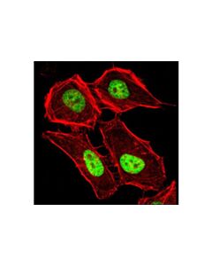 Cell Signaling Macroh2a1.2 Antibody