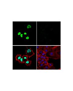 Cell Signaling BRD9 (E4Q3F) Rabbit mAb 20 uL